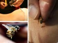 蜜蜂治疗风原理（蜜蜂疗法有副作用吗）